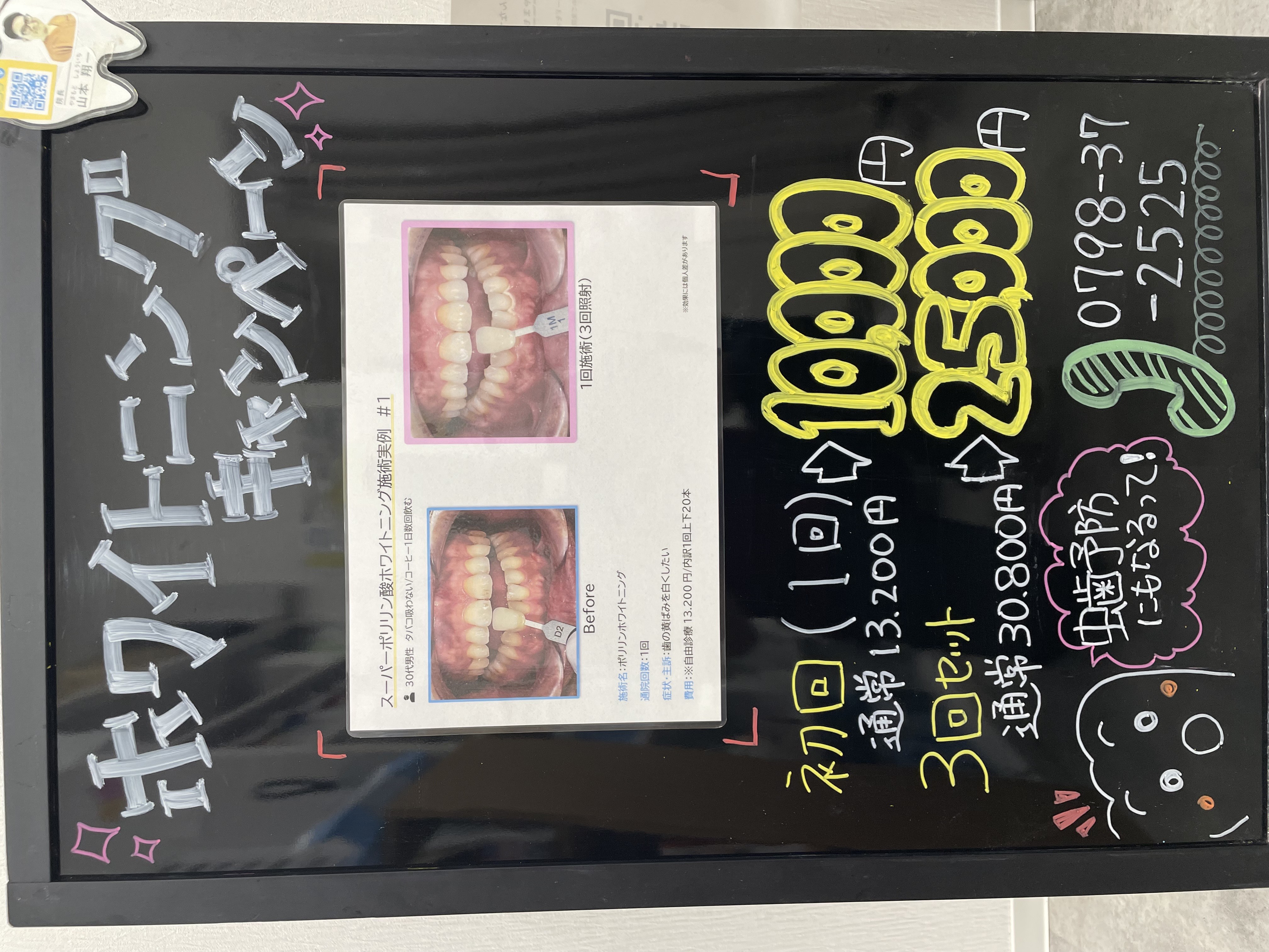 ホワイトニングキャンペーン