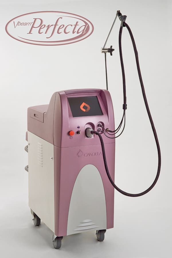 Vビームレーザー