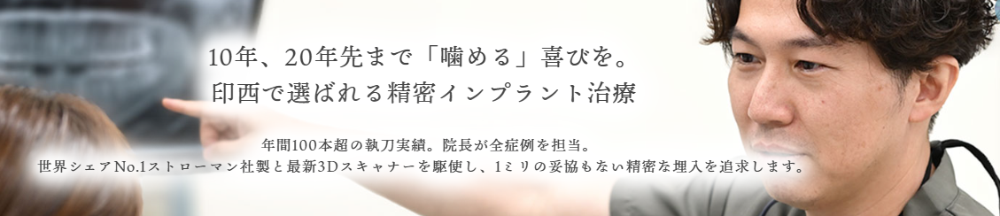 【リニューアル！】「インプラント治療」ページを公開しました！